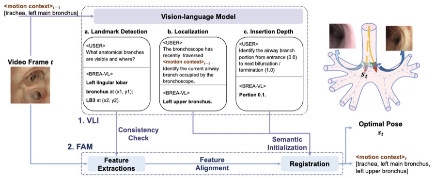 BREATH-VL method overview